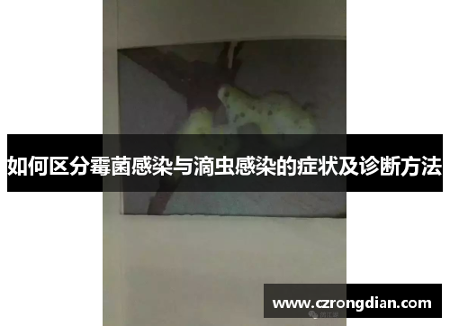 如何区分霉菌感染与滴虫感染的症状及诊断方法
